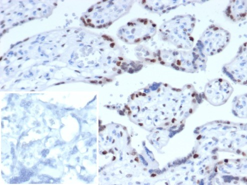 IHC analysis of formalin-fixed, paraffin-embedded human placenta. Strong nuclear staining using p57 Kip2 antibody (KIP2/7187) at 2ug/ml in PBS for 30min RT. Inset: PBS instead of primary antibody; secondary only negative control.