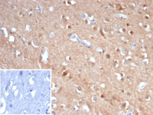 Formalin-fixed, paraffin-embedded human brain stained with beta-III Tubulin antibody (rTUBB3/7406). Inset: PBS instead of primary antibody; secondary only negative control.