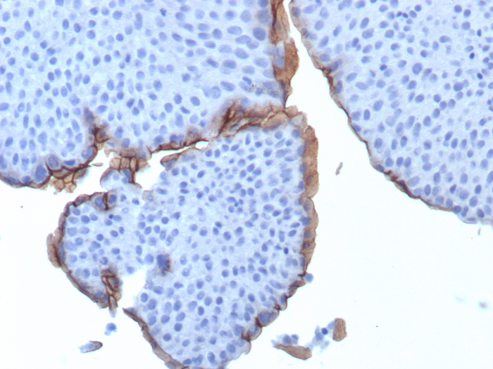 Formalin-fixed, paraffin-embedded human bladder stained with Uroplakin IIIB antibody (UPK3B/3270). HIER: Tris/EDTA, pH9.0, 45min. Secondary: HRP-polymer, 30min. DAB, 5min.