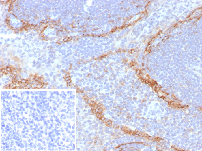 Formalin-fixed, paraffin-embedded human tonsil stained with Podoplanin antibody (rPDPN/6994). Inset: PBS instead of primary antibody; secondary only negative control.