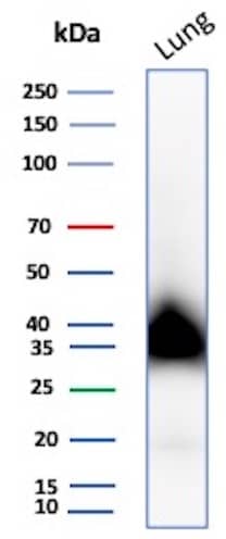 Western blot analysis of human Lung tissue lysate using Podoplanin Antibody (rPDPN/6994) - Azide and BSA Free.