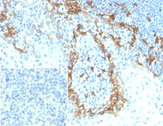 Formalin-fixed, paraffin-embedded human tonsil stained with Podoplanin antibody (PDPN/7808R). Inset: PBS instead of primary antibody; secondary only negative control.
