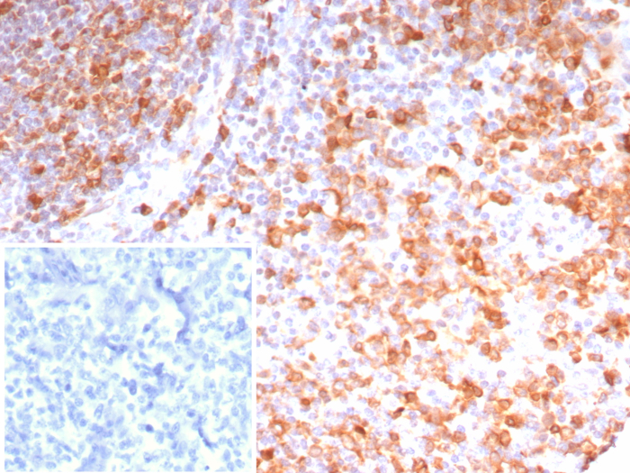 Formalin-fixed, paraffin-embedded human tonsil stained with Stathmin 1 antibody (STMN1/8023R). Inset: PBS instead of primary antibody; secondary only negative control.