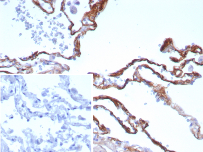Formalin-fixed, paraffin-embedded human lung stained with Periostin/OSF-2 antibody (rPOSTN/8522). Inset: PBS instead of primary antibody; secondary only negative control.