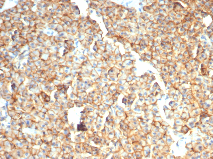 Formalin-fixed, paraffin-embedded dog liver stained with EpCAM/TROP1 antibody (rEGP40/7334). HIER: Tris/EDTA, pH9.0, 45min. Secondary: HRP-polymer, 30min. DAB, 5min.