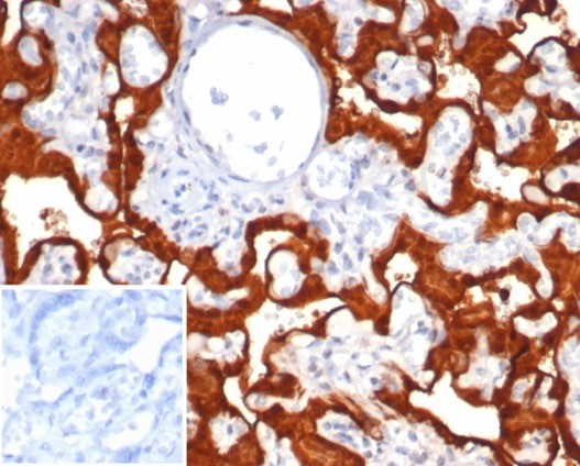 Formalin-fixed, paraffin-embedded human placenta stained with S100P antibody (S100P/7375). Inset: PBS instead of primary antibody; secondary only negative control.