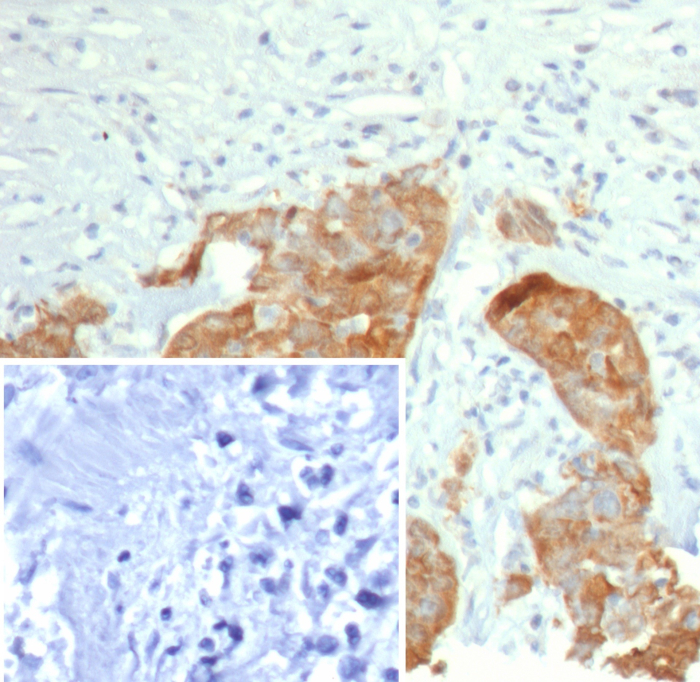 Formalin-fixed, paraffin-embedded human bladder stained with S100P antibody (S100P/7978R). Inset: PBS instead of primary antibody; secondary only negative control.