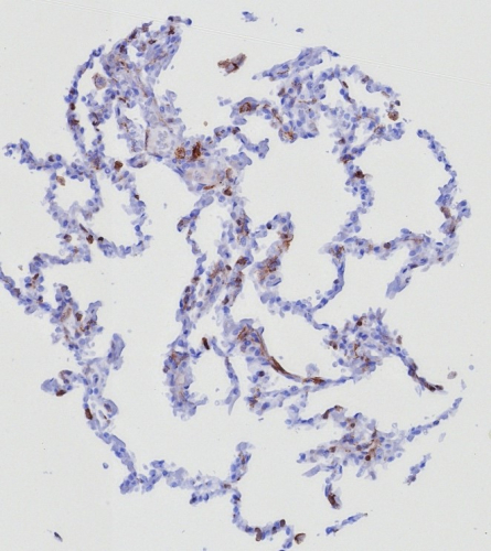 Formalin-fixed, paraffin-embedded human lung stained with PSGL-1/CD162 antibody (PSGL1/8135R).