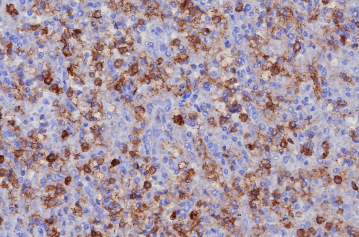 Formalin-fixed, paraffin-embedded human spleen stained with PSGL-1/CD162 antibody (PSGL1/8192R). HIER: Tris/EDTA, pH9.0, 45min. Secondary: HRP-polymer, 30min. DAB, 5min.