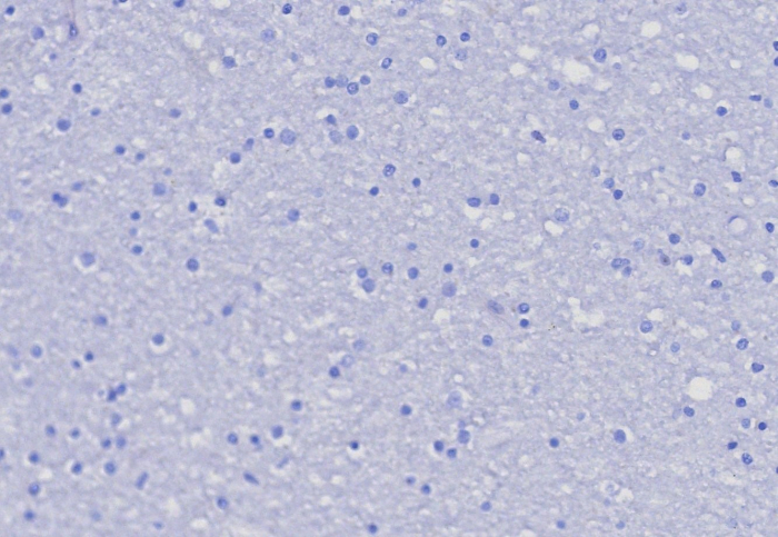 IHC analysis of formalin-fixed, paraffin-embedded human brain. Negative tissue control using PSGL-1/CD162 antibody (PSGL1/8192R) at 2ug/ml in PBS for 30min RT. HIER: Tris/EDTA, pH9.0, 45min. Secondary: HRP-polymer, 30min. DAB, 5min.