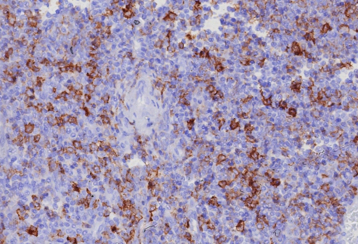 Formalin-fixed, paraffin-embedded human tonsil stained with PSGL-1/CD162 antibody (PSGL1/8192R). HIER: Tris/EDTA, pH9.0, 45min. Secondary: HRP-polymer, 30min. DAB, 5min.