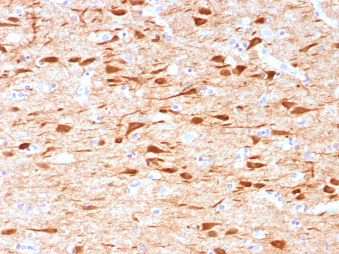 Formalin-fixed, paraffin-embedded human brain stained with NECAB1 antibody (NECAB1/7677). HIER: Tris/EDTA, pH9.0, 45min. Secondary: HRP-polymer, 30min. DAB, 5min.