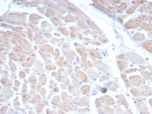 Formalin-fixed, paraffin-embedded human heart stained with Somatostatin R2/SSTR2 antibody (SSTR2/7532).