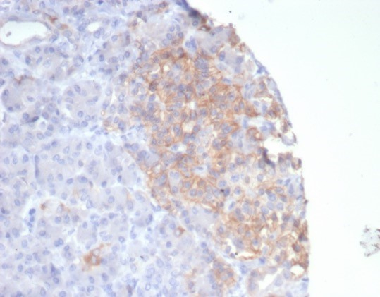 Formalin-fixed, paraffin-embedded human pancreas stained with Somatostatin R2/SSTR2 antibody (SSTR2/7532). HIER: Tris/EDTA, pH9.0, 45min. Secondary: HRP-polymer, 30min. DAB, 5min.