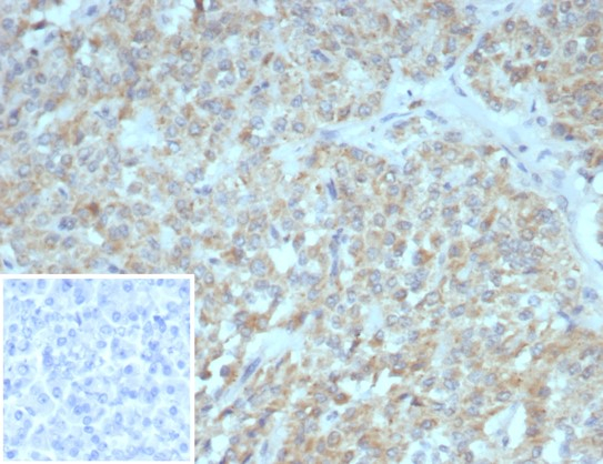 Formalin-fixed, paraffin-embedded human pancreas stained with Somatostatin R2/SSTR2 antibody (SSTR2/7532). Inset: PBS instead of primary antibody; secondary only negative control.