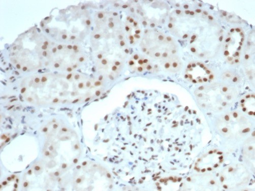 Formalin-fixed, paraffin-embedded human kidney stained with Brg1 antibody (BRG1/6531R). HIER: Tris/EDTA, pH9.0, 45min. Secondary: HRP-polymer, 30min. DAB, 5min.
