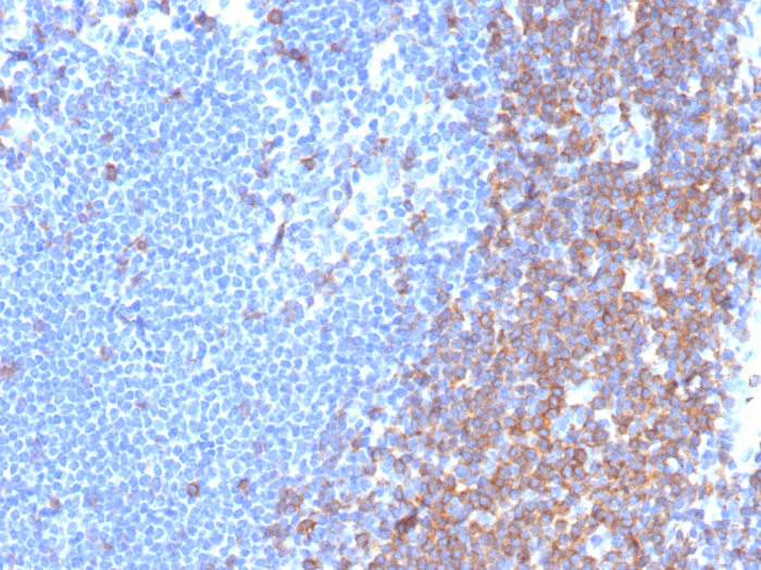 Formalin-fixed, paraffin-embedded human lymph node stained with CD7 antibody (rCD7/6972). HIER: Tris/EDTA, pH9.0, 45min. Secondary: HRP-polymer, 30min. DAB, 5min.