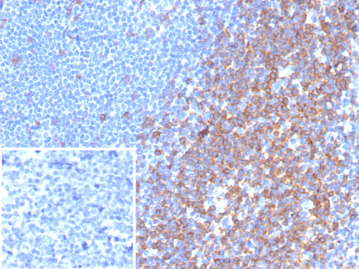 Formalin-fixed, paraffin-embedded human tonsil stained with CD7 antibody (rCD7/6972). Inset: PBS instead of primary antibody; secondary only negative control.
