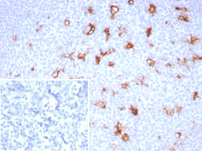 Formalin-fixed, paraffin-embedded human tonsil stained with SPARC antibody (OSTN/8528R). Inset: PBS instead of primary antibody; secondary only negative control.