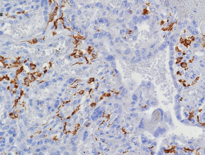 Formalin-fixed, paraffin-embedded human placenta stained with CD163 antibody (M130/8361R). HIER: Tris/EDTA, pH9.0, 45min. 2: HRP-polymer, 30min. DAB, 5min.