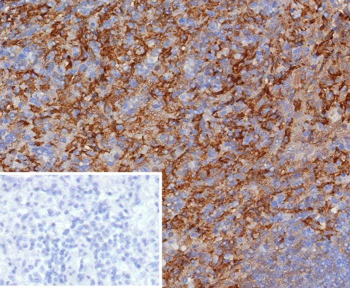 Formalin-fixed, paraffin-embedded human spleen stained with CD163 antibody (M130/8361R). HIER: Tris/EDTA, pH9.0, 45min. 2: HRP-polymer, 30min. DAB, 5min.