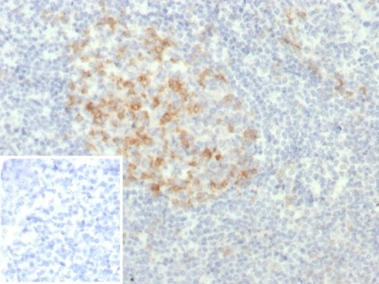 Formalin-fixed, paraffin-embedded human tonsil stained with PD-1 antibody (PDCD1/7276R). Inset: PBS instead of primary antibody; secondary only negative control.