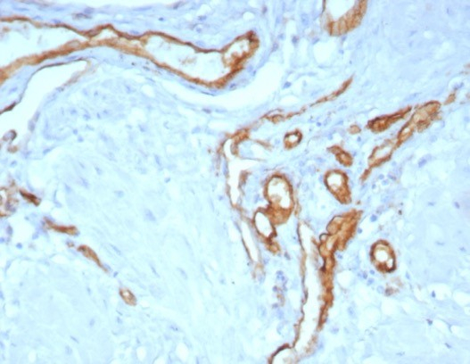 Formalin-fixed, paraffin-embedded human uterus stained with CD31/PECAM-1 antibody (C31/8243R). HIER: Tris/EDTA, pH9.0, 45min. Secondary: HRP-polymer, 30min. DAB, 5min.