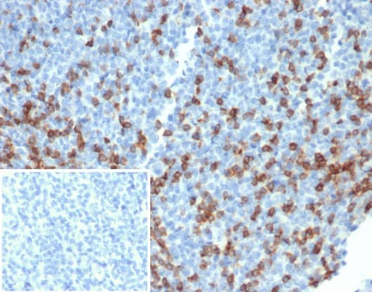 Formalin-fixed, paraffin-embedded human tonsil stained with PD1 (CD279) Recombinant Rabbit Monoclonal Antibody (PDCD1/4231R). Inset: PBS instead of primary antibody; secondary only negative control.