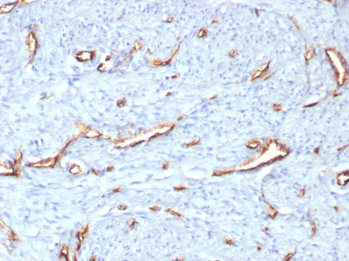 Formalin-fixed, paraffin-embedded human uterus stained with CD31/PECAM-1 antibody (C31/8359R). HIER: Tris/EDTA, pH9.0, 45min. Secondary: HRP-polymer, 30min. DAB, 5min.