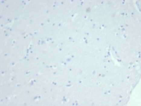 IHC analysis of formalin-fixed, paraffin-embedded human brain. Negative tissue control using Cytokeratin 14 antibody (rKRT14/7368)). at 2ug/ml in PBS for 30min RT. HIER: Tris/EDTA, pH9.0, 45min. Secondary: HRP-polymer, 30min. DAB, 5min.