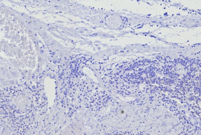 IHC analysis of formalin-fixed, paraffin-embedded human skin in tonsil. Negative tissue control using BOB1 antibody (BOB1/7469) at 2ug/ml in PBS for 30min RT. HIER: Tris/EDTA, pH9.0, 45min. Secondary: HRP-polymer, 30min. DAB, 5min.