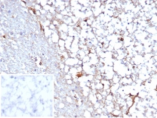 Formalin-fixed, paraffin-embedded human cerebellum stained with STAT6 antibody (STAT6/7163R). Inset: PBS instead of primary antibody; secondary only negative control.
