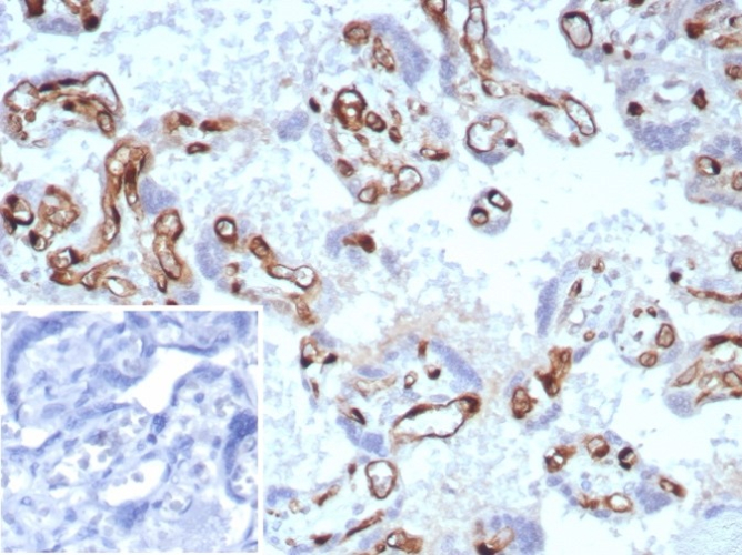IHC analysis of formalin-fixed, paraffin-embedded human placenta. Stained using FABP4/A-FABP antibody (rFABP4/8536) at 2ug/ml in PBS for 30min RT. Inset: PBS instead of primary antibody; secondary only negative control.