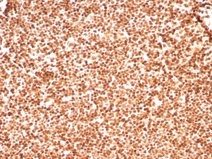 Formalin-fixed, paraffin-embedded human lymph node stained with H1F0 antibody (rHH1/8702). HIER: Tris/EDTA, pH9.0, 45min. Secondary: HRP-polymer, 30min. DAB, 5min.