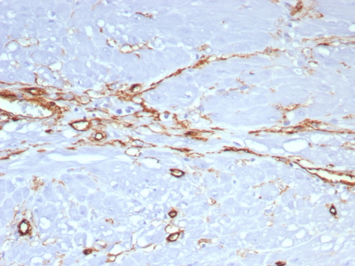 Formalin-fixed, paraffin-embedded human uterus stained with CD34 antibody (rHPCA1/8573). HIER: Tris/EDTA, pH9.0, 45min. Secondary: HRP-polymer, 30min. DAB, 5min.