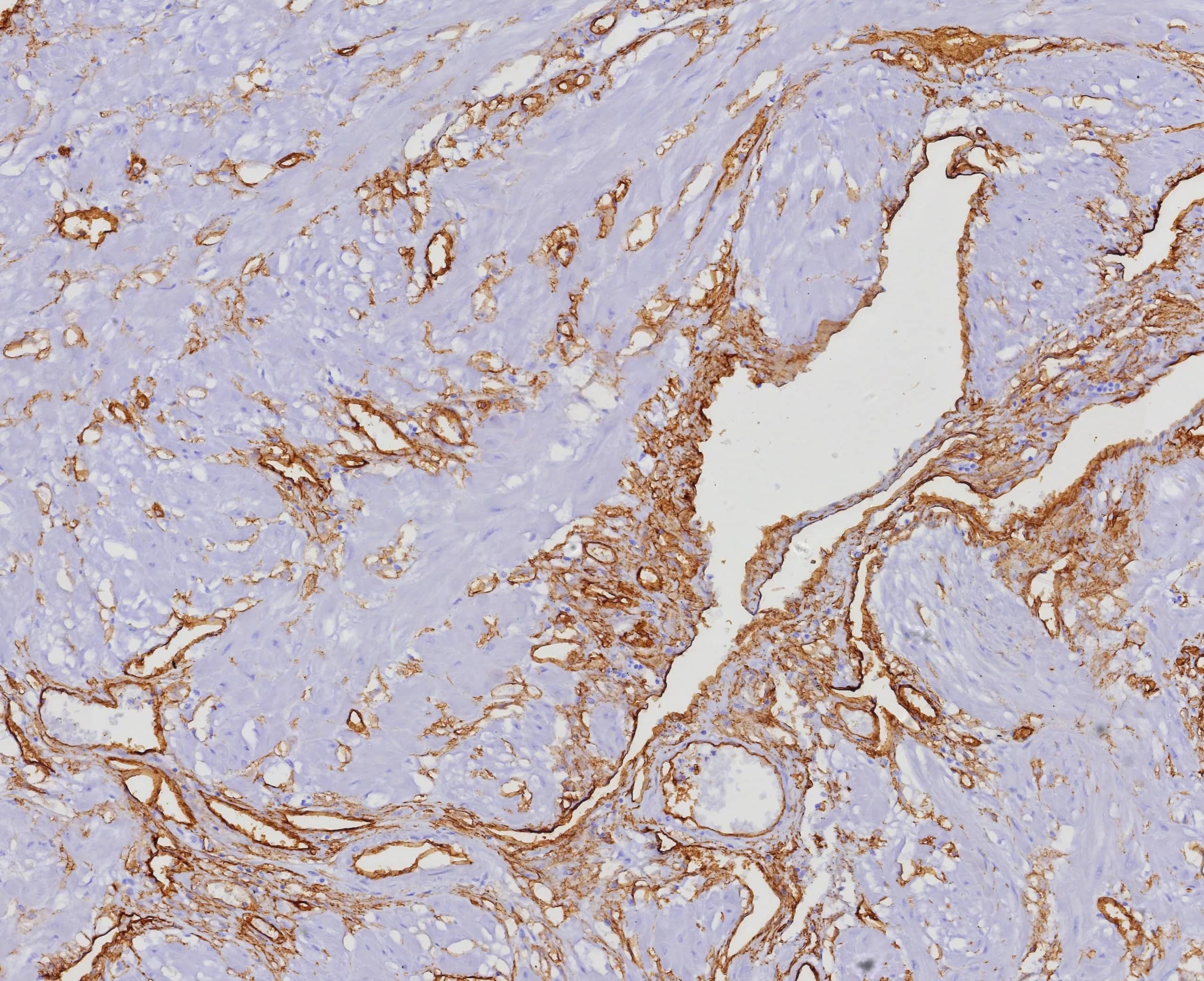 Immunohistochemistry-Paraffin: CD34 Antibody (HPCA1/4393R) - Azide and BSA Free [NBP3-20988] - Formalin-fixed, paraffin-embedded human uterus stained with CD34 Antibody (HPCA1/4393R). HIER: Tris/EDTA, pH9.0, 45min. 2°: HRP-polymer, 30min. DAB, 5min.