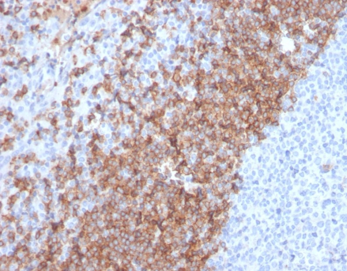 Formalin-fixed, paraffin-embedded human tonsil stained with IgD antibody (IGHD/2730R). HIER: Tris/EDTA, pH9.0, 45min. Secondary: HRP-polymer, 30min. DAB, 5min.