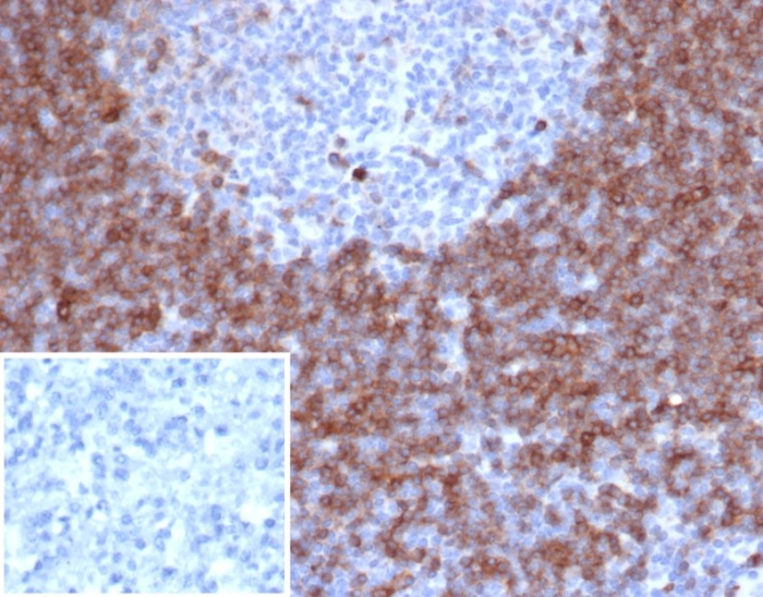 Formalin-fixed, paraffin-embedded human lymph node stained with IgD antibody (IGHD/6818R). Inset: PBS instead of primary antibody; secondary only negative control.