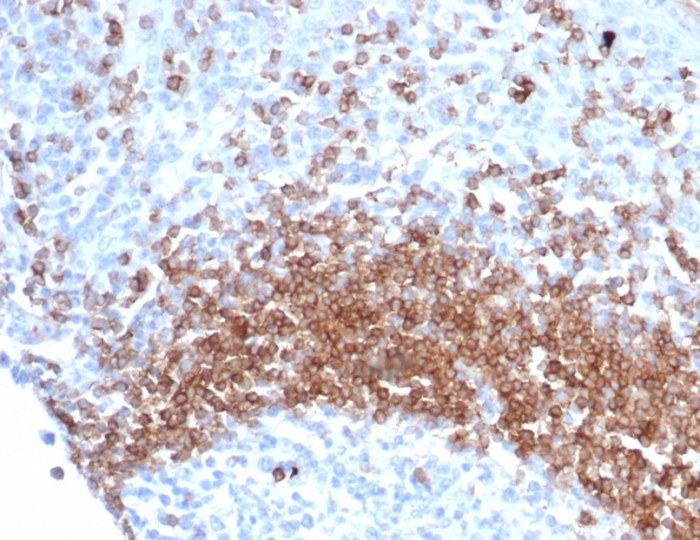 Formalin-fixed, paraffin-embedded human tonsil stained with IgD antibody (IGHD/6818R). Inset: PBS instead of primary antibody; secondary only negative control.