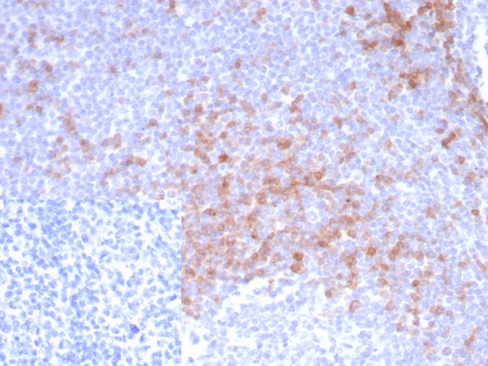 Formalin-fixed, paraffin-embedded human tonsil stained with IgD antibody (IGHD/8228R). Inset: PBS instead of primary antibody; secondary only negative control.