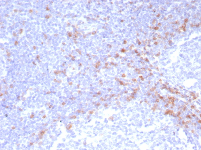 Formalin-fixed, paraffin-embedded human tonsil stained with IgD antibody (IGHD/8228R). HIER: Tris/EDTA, pH9.0, 45min. Secondary: HRP-polymer, 30min. DAB, 5min.