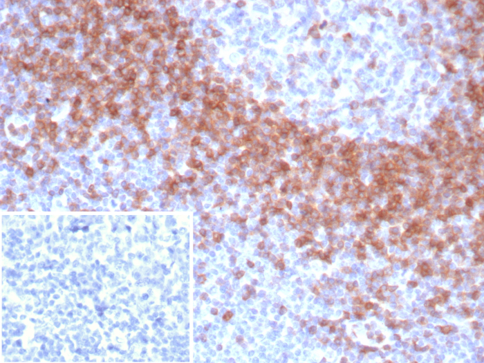 Formalin-fixed, paraffin-embedded human tonsil stained with IgD antibody (IGHD/8367R). Inset: PBS instead of primary antibody; secondary only negative control.