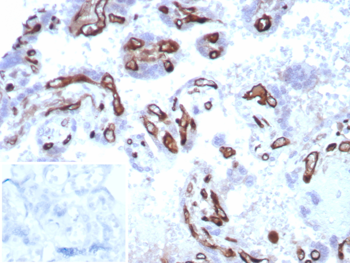 IHC analysis of formalin-fixed, paraffin-embedded human placenta. Stained using FABP4/A-FABP antibody (FABP4/8537R) at 2ug/ml in PBS for 30min RT. Inset: PBS instead of primary antibody; secondary only negative control.