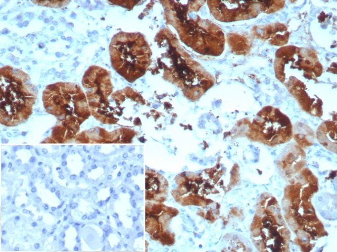 Formalin-fixed, paraffin-embedded human kidney stained with FABP1/L-FABP antibody (rFABP1/8520). Inset: PBS instead of primary antibody; secondary only negative control.