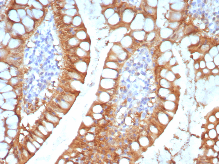 Formalin-fixed, paraffin-embedded human small intestine stained with FABP2/I-FABP antibody (FABP2/7670). HIER: Tris/EDTA, pH9.0, 45min. Secondary: HRP-polymer, 30min. DAB, 5min.