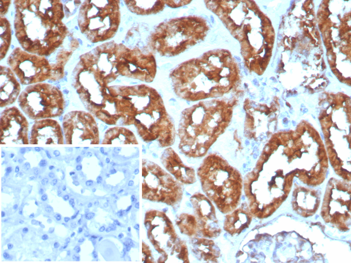 Formalin-fixed, paraffin-embedded human heart stained with FABP3/H-FABP antibody (FABP3/8535R). HIER: Tris/EDTA, pH9.0, 45min. Secondary: HRP-polymer, 30min. DAB, 5min.