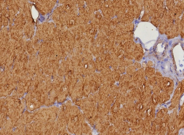 Formalin-fixed, paraffin-embedded human heart stained with FABP3/H-FABP antibody (FABP3/8343R). HIER: Tris/EDTA, pH9.0, 45min. 2: HRP-polymer, 30min. DAB, 5min.