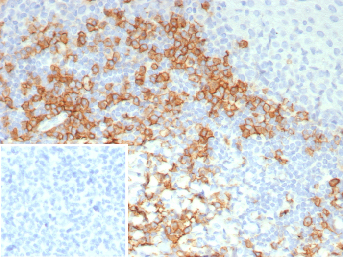Formalin-fixed, paraffin-embedded human tonsil stained with CD38 antibody (CD38/8114R). Inset: PBS instead of primary antibody; secondary only negative control.
