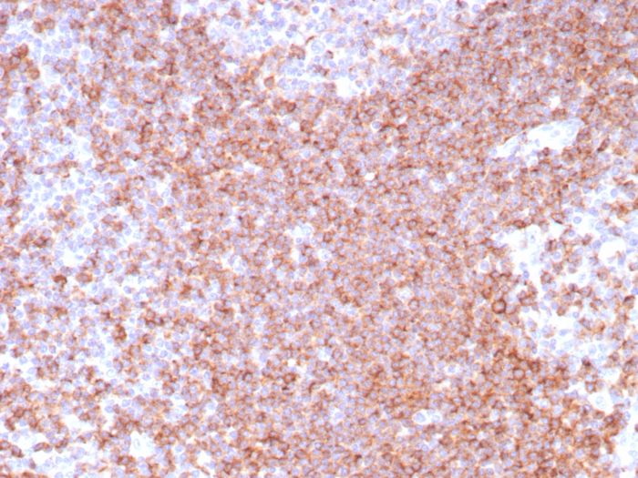 Formalin-fixed, paraffin-embedded human tonsil stained with CD39/ENTPD1 antibody (CD39/8538R). HIER: Tris/EDTA, pH9.0, 45min. Secondary: HRP-polymer, 30min. DAB, 5min.