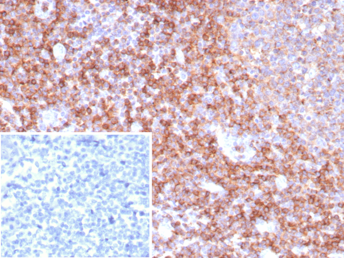 Formalin-fixed, paraffin-embedded human tonsil stained with CD39/ENTPD1 antibody (CD39/8538R). Inset: PBS instead of primary antibody; secondary only negative control.
